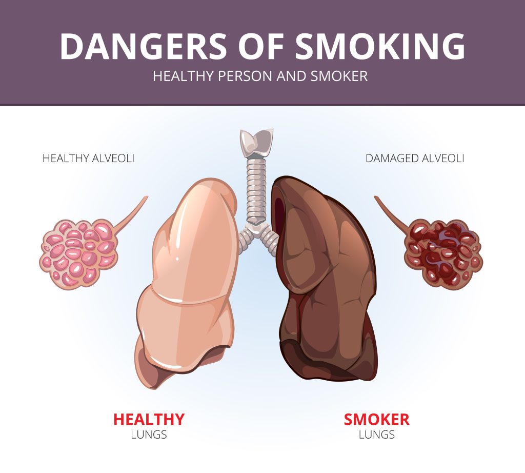 healthy lung vs smoker lung